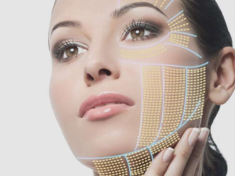 All You Need to Know About Face Slimming Procedures